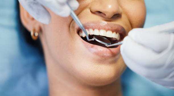 Best Broken or Chipped Tooth Repair in Mount Vernon, OH