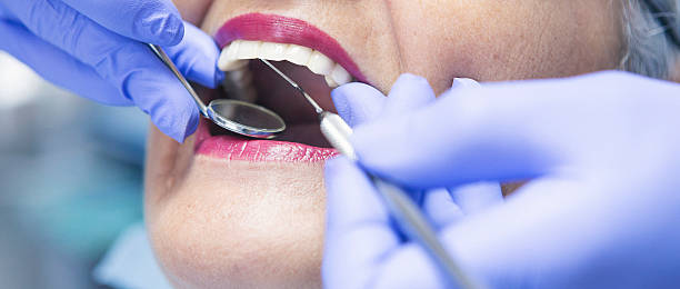Best Dental Abscess Treatment in Mount Vernon, OH